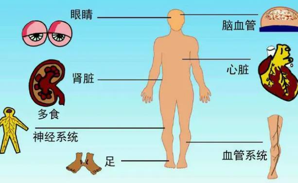 糖尿病會(huì)造成飛蚊癥嗎 糖尿病有哪些癥狀