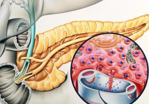 胰腺癌到底有多可怕？ 哪些人容易得胰腺癌？