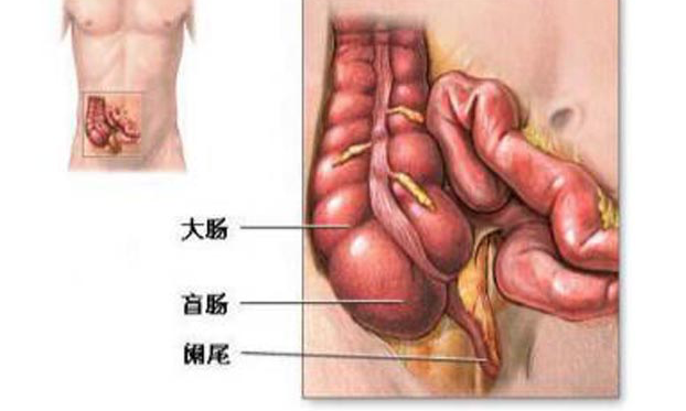 闌尾炎手術(shù)后能跑步嗎 闌尾炎手術(shù)后怎么養(yǎng)護(hù)