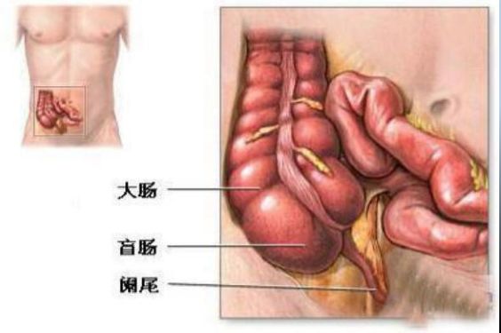 急性闌尾炎有哪些癥狀 闌尾炎后遺癥有哪些