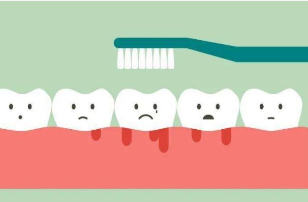 周炎食療 ？牙周炎洗牙需要注意哪些？