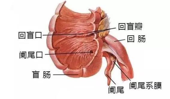 闌尾炎能治好嗎 慢性闌尾炎會變成急性闌尾炎嗎？