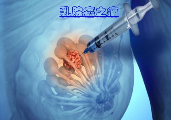 這些食物可以預(yù)防乳腺癌 ？乳腺癌手術(shù)后多久化療？