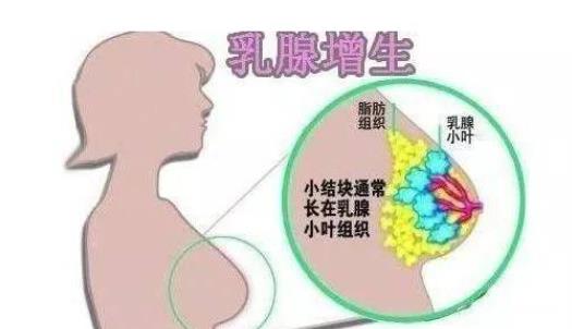 乳腺增生多久才能治愈 乳腺增生和不典型增生有哪些區(qū)別