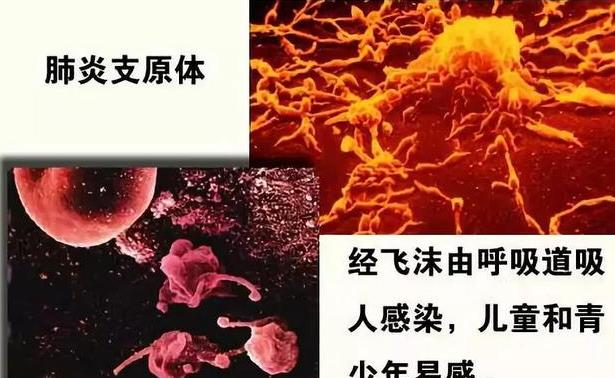 肺炎支原體抗體陽(yáng)性多久可以痊愈 肺炎能自愈嗎