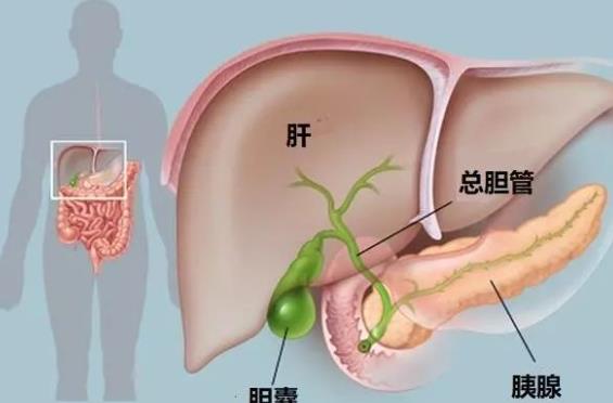 膽結(jié)石可以吃蛋白嗎 問膽結(jié)石可以吃巧克力嗎