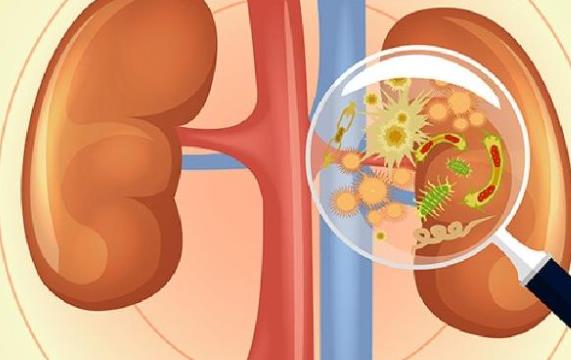 腎結(jié)石有哪些癥狀 腎結(jié)石在腎里會(huì)痛嗎